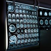 L'intelligenza artificiale, un aiuto in più per la diagnosi e il monitoraggio del Parkinson L'intelligenza artificiale, un aiuto in più per la diagnosi e il monitoraggio del Parkinson