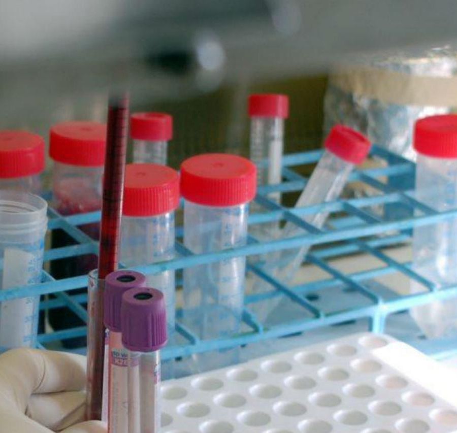 Coronavirus Piemonte, 3 nuovi decessi, 840 positivi, sperimentazione nuovo test, accesso alla terapia intensiva, donazione della comunità cinese