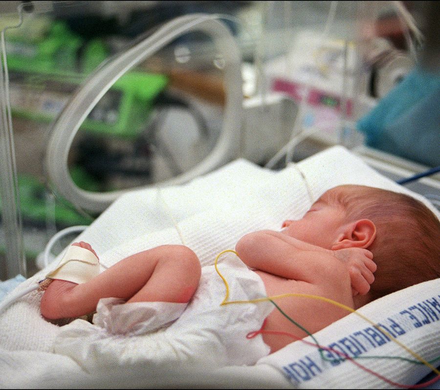 I Rotary donano un Green Laser System alla Neonatologia dell'ospedale Sant'Anna di Torino